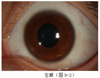 ZY016_39_3.gif